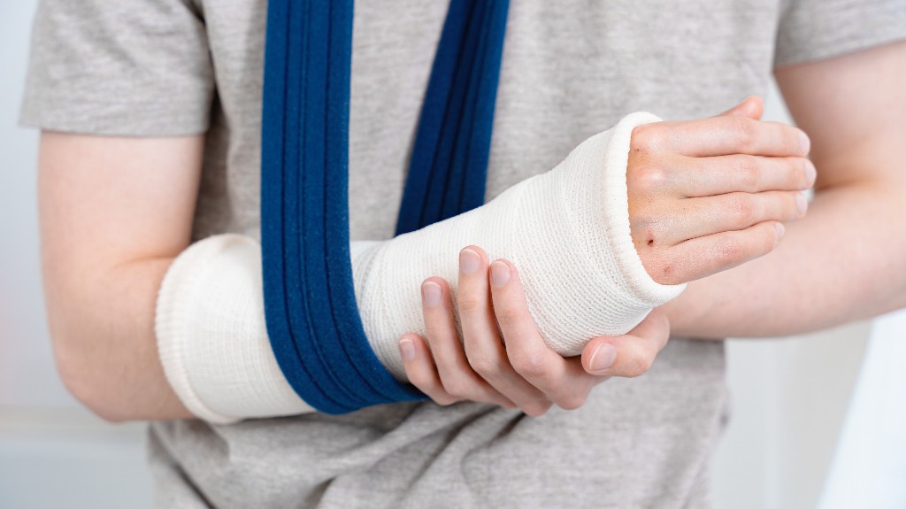 person with a broken arm in a white cast